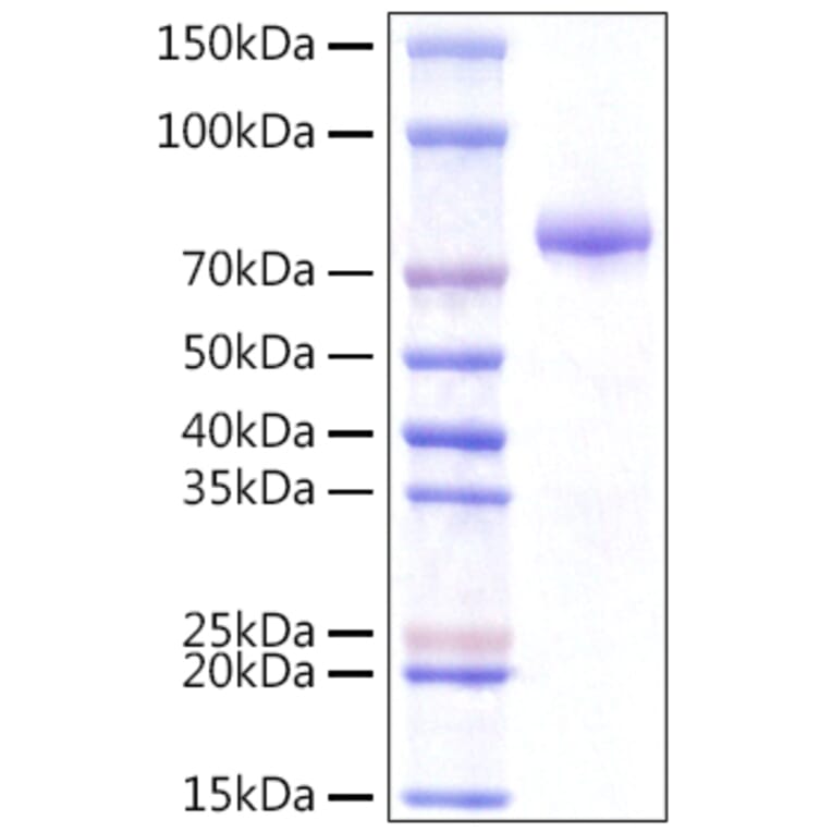 SDS-PAGE - Recombinant Human INTS14 Protein (N-terminal Rabbit Fc Tag) (A331701) - Antibodies.com