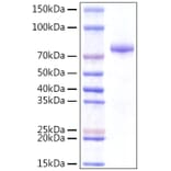 SDS-PAGE - Recombinant Human INTS14 Protein (N-terminal Rabbit Fc Tag) (A331701) - Antibodies.com