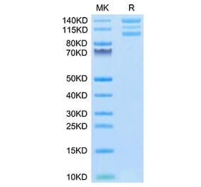 Tris-Bis PAGE - Recombinant Human Integrin alpha V + beta 6 Protein (C-terminal His and Avi Tag) (A331703) - Antibodies.com
