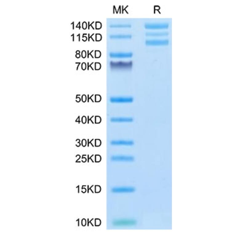 Tris-Bis PAGE - Recombinant Human Integrin alpha V + beta 6 Protein (C-terminal His and Avi Tag) (A331703) - Antibodies.com