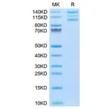 Tris-Bis PAGE - Recombinant Human Integrin alpha V + beta 6 Protein (C-terminal His and Avi Tag) (A331703) - Antibodies.com