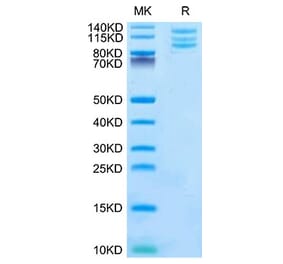 Tris-Bis PAGE - Recombinant Mouse Integrin alpha V + beta 6 Protein (C-terminal His Tag) (A331704) - Antibodies.com