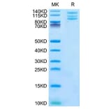 Tris-Bis PAGE - Recombinant Mouse Integrin alpha V + beta 6 Protein (C-terminal His Tag) (A331704) - Antibodies.com