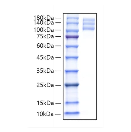 SDS-PAGE - Recombinant Human Integrin alpha V + beta 3 Protein (C-terminal His and Flag Tag) (A331706) - Antibodies.com