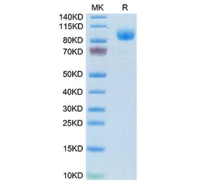 Tris-Bis PAGE - Recombinant Mouse IFNAR1 Protein (C-terminal Human Fc Tag) (A331707) - Antibodies.com