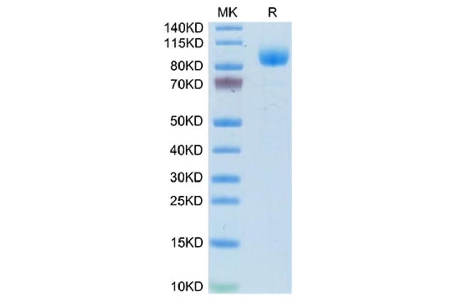 Tris-Bis PAGE - Recombinant Mouse IFNAR1 Protein (C-terminal Human Fc Tag) (A331707) - Antibodies.com
