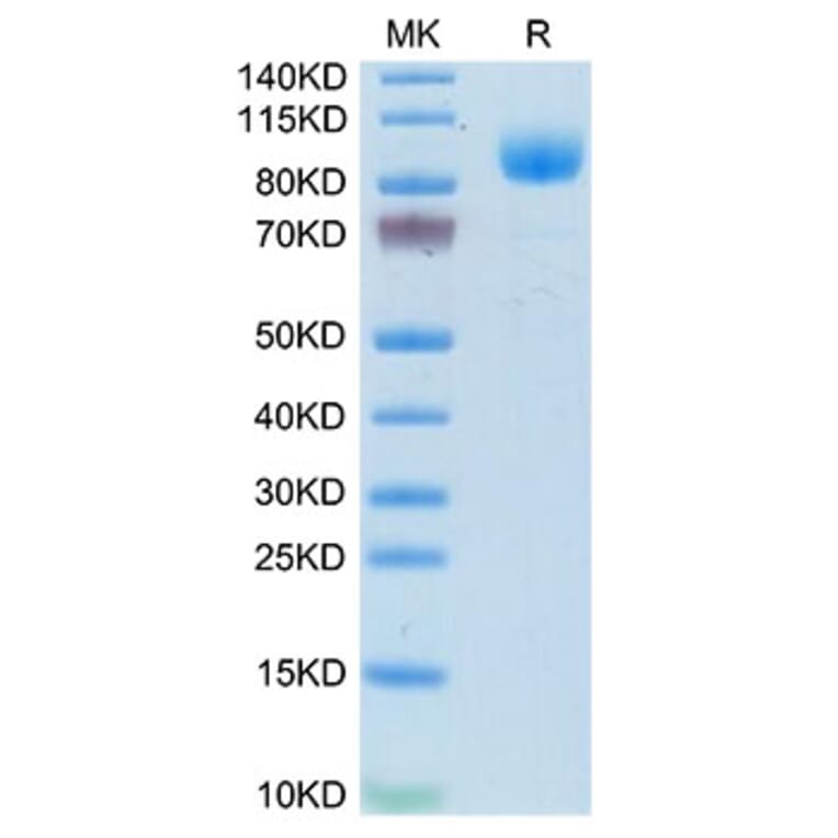 Tris-Bis PAGE - Recombinant Mouse IFNAR1 Protein (C-terminal Human Fc Tag) (A331707) - Antibodies.com