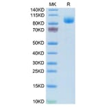 Tris-Bis PAGE - Recombinant Mouse IFNAR1 Protein (C-terminal Human Fc Tag) (A331707) - Antibodies.com