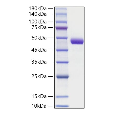 SDS-PAGE - Recombinant Human Intrinsic factor Protein (C-terminal His Tag) (A331708) - Antibodies.com