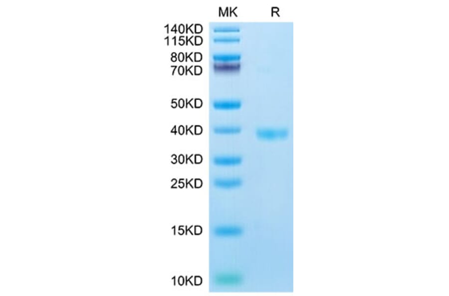 Tris-Bis PAGE - Recombinant Mouse JAM-A Protein (C-terminal His Tag) (A331712) - Antibodies.com