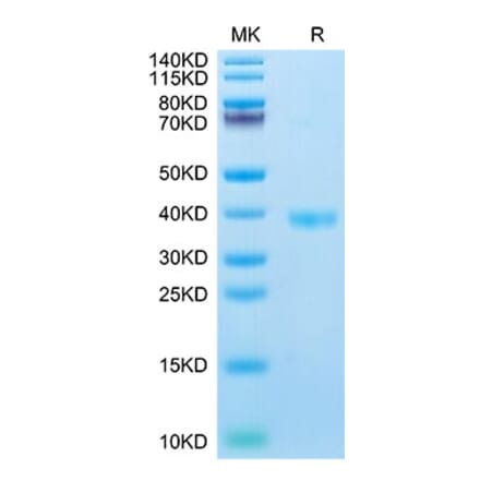 Tris-Bis PAGE - Recombinant Mouse JAM-A Protein (C-terminal His Tag) (A331712) - Antibodies.com