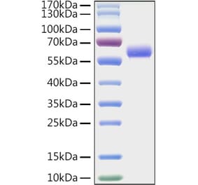 SDS-PAGE - Recombinant Mouse LAG-3 Protein (C-terminal His Tag) (A331713) - Antibodies.com
