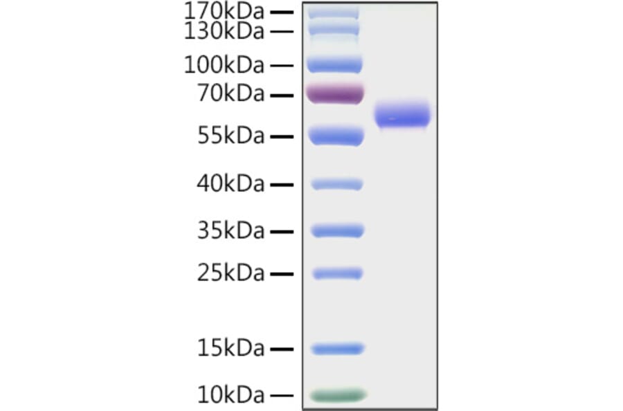 SDS-PAGE - Recombinant Mouse LAG-3 Protein (C-terminal His Tag) (A331713) - Antibodies.com