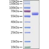 SDS-PAGE - Recombinant Mouse LAG-3 Protein (C-terminal His Tag) (A331713) - Antibodies.com