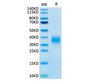 Tris-Bis PAGE - Recombinant Mouse LAIR1 Protein (C-terminal His Tag) (A331714) - Antibodies.com