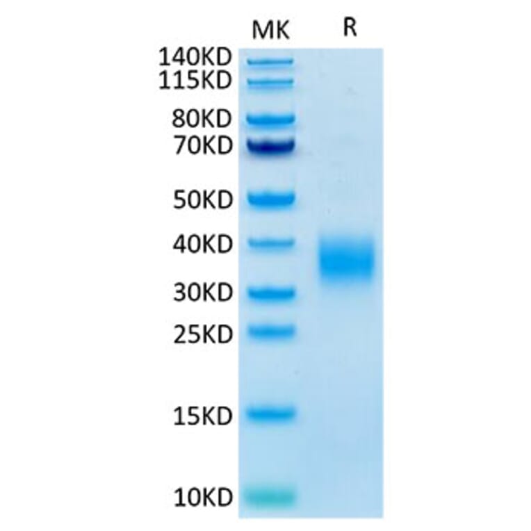 Tris-Bis PAGE - Recombinant Mouse LAIR1 Protein (C-terminal His Tag) (A331714) - Antibodies.com
