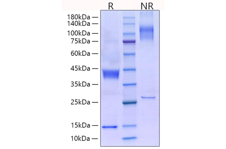 SDS-PAGE - Recombinant Rat Latent TGF-beta 1 Protein (N-terminal His Tag) (A331717) - Antibodies.com