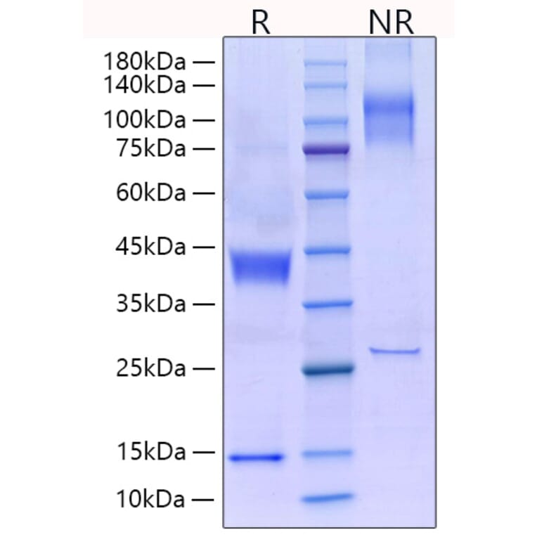 SDS-PAGE - Recombinant Rat Latent TGF-beta 1 Protein (N-terminal His Tag) (A331717) - Antibodies.com