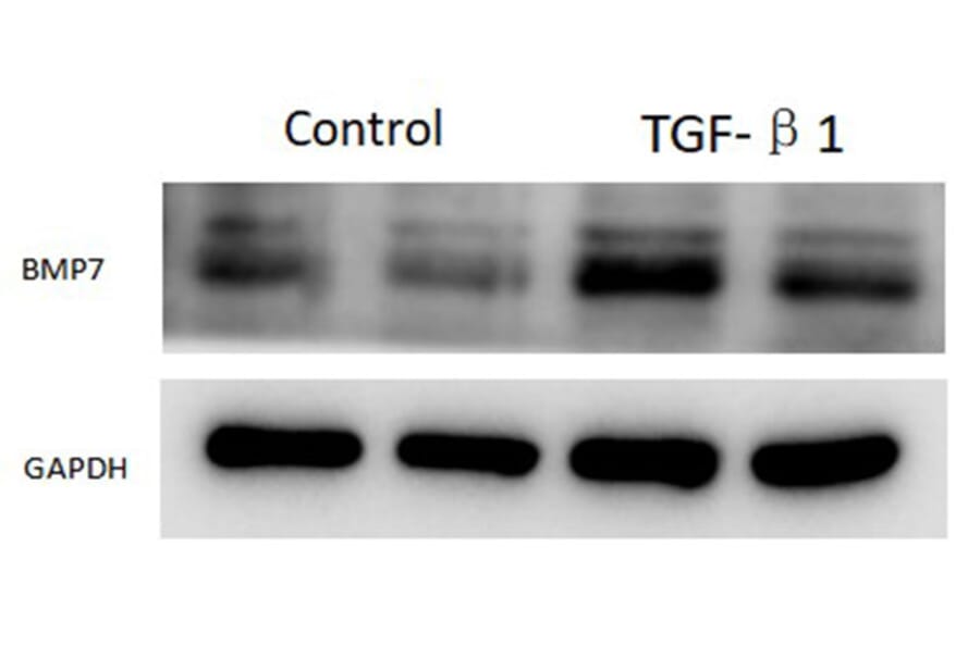 Western Blot - Recombinant Rat Latent TGF-beta 1 Protein (N-terminal His Tag) (A331717) - Antibodies.com