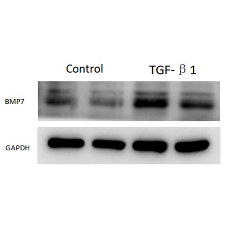 Western Blot - Recombinant Rat Latent TGF-beta 1 Protein (N-terminal His Tag) (A331717) - Antibodies.com