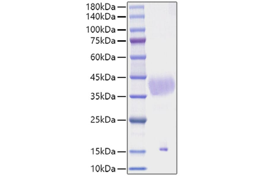 SDS-PAGE - Recombinant Mouse Latent TGF-beta 1 Protein (N-terminal His Tag) (A331718) - Antibodies.com