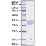 SDS-PAGE - Recombinant Mouse Latent TGF-beta 1 Protein (N-terminal His Tag) (A331718) - Antibodies.com