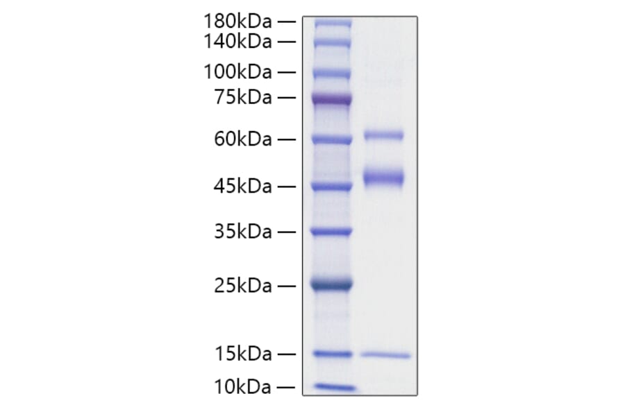 SDS-PAGE - Recombinant Mouse Latent TGF-beta 2 Protein (N-terminal His Tag) (A331719) - Antibodies.com
