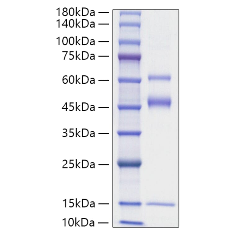 SDS-PAGE - Recombinant Mouse Latent TGF-beta 2 Protein (N-terminal His Tag) (A331719) - Antibodies.com