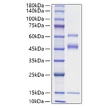 SDS-PAGE - Recombinant Mouse Latent TGF-beta 2 Protein (N-terminal His Tag) (A331719) - Antibodies.com