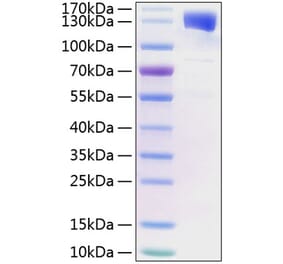 SDS-PAGE - Recombinant Mouse Leptin Receptor Protein (C-terminal His Tag) (A331720) - Antibodies.com