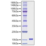 SDS-PAGE - Recombinant Rat Leptin Protein (A331721) - Antibodies.com
