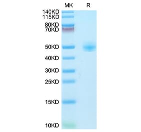 Tris-Bis PAGE - Recombinant Rhesus macaque CD4 Protein (C-terminal His Tag) (A331722) - Antibodies.com