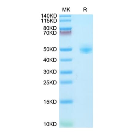 Tris-Bis PAGE - Recombinant Rhesus macaque CD4 Protein (C-terminal His Tag) (A331722) - Antibodies.com