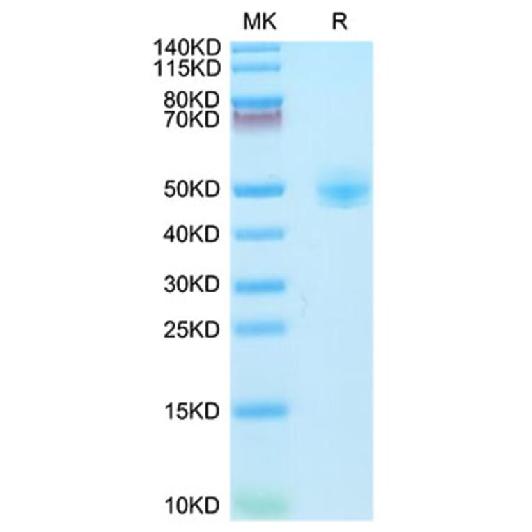 Tris-Bis PAGE - Recombinant Rhesus macaque CD4 Protein (C-terminal His Tag) (A331722) - Antibodies.com