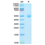Tris-Bis PAGE - Recombinant Rhesus macaque CD4 Protein (C-terminal His Tag) (A331722) - Antibodies.com