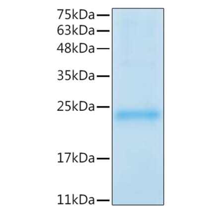 SDS-PAGE - Recombinant Mouse LIF Protein (C-terminal His Tag) (A331724) - Antibodies.com
