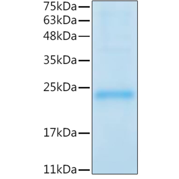 SDS-PAGE - Recombinant Mouse LIF Protein (C-terminal His Tag) (A331724) - Antibodies.com