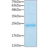 SDS-PAGE - Recombinant Mouse LIF Protein (C-terminal His Tag) (A331724) - Antibodies.com