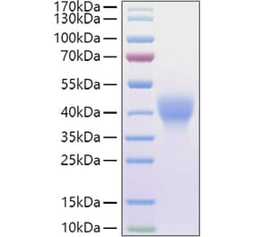 SDS-PAGE - Recombinant Mouse LIF Protein (C-terminal His and Avi Tag) (A331725) - Antibodies.com