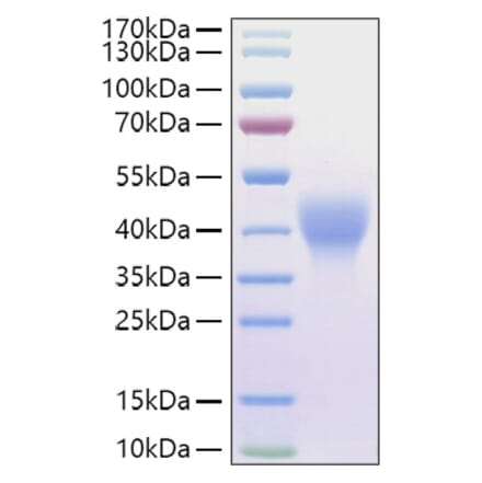 SDS-PAGE - Recombinant Mouse LIF Protein (C-terminal His and Avi Tag) (A331725) - Antibodies.com