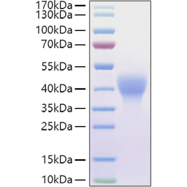 SDS-PAGE - Recombinant Mouse LIF Protein (C-terminal His and Avi Tag) (A331725) - Antibodies.com