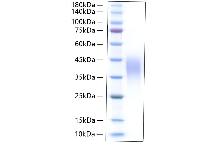 SDS-PAGE - Recombinant Rat LIF Protein (C-terminal His Tag) (A331726) - Antibodies.com