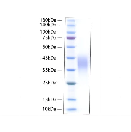 SDS-PAGE - Recombinant Rat LIF Protein (C-terminal His Tag) (A331726) - Antibodies.com