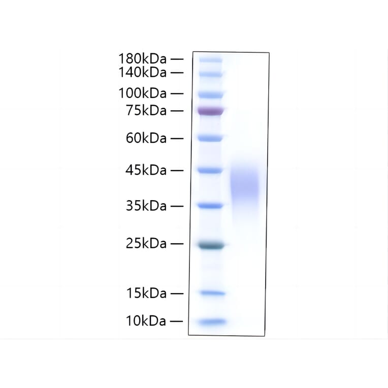 SDS-PAGE - Recombinant Rat LIF Protein (C-terminal His Tag) (A331726) - Antibodies.com