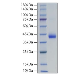 SDS-PAGE - Recombinant Human LHB Protein (C-terminal His and Avi Tag) (A331727) - Antibodies.com