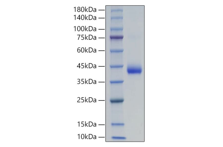 SDS-PAGE - Recombinant Human LHB Protein (C-terminal His and Avi Tag) (A331727) - Antibodies.com
