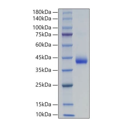 SDS-PAGE - Recombinant Human LHB Protein (C-terminal His and Avi Tag) (A331727) - Antibodies.com