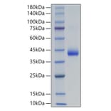 SDS-PAGE - Recombinant Human LHB Protein (C-terminal His and Avi Tag) (A331727) - Antibodies.com