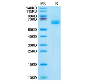 Tris-Bis PAGE - Recombinant Cynomolgus macaque LILRA4 Protein (C-terminal His Tag) (A331728) - Antibodies.com