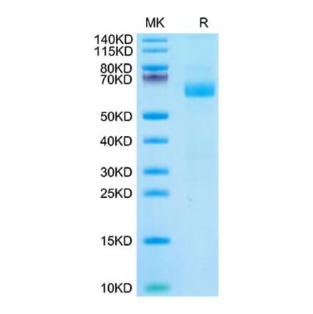 Tris-Bis PAGE - Recombinant Cynomolgus macaque LILRA4 Protein (C-terminal His Tag) (A331728) - Antibodies.com